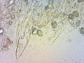 Hymenopellis radicata