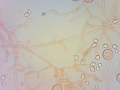 Tremella mycophaga