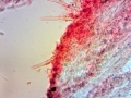 Cotylidia muscigena