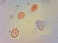 Lachnella alboviolascens